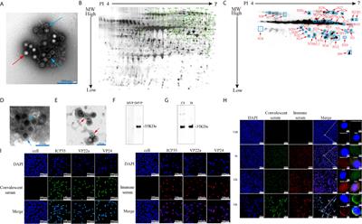 Immunological Identification and Characterization of the Capsid Scaffold Protein Encoded by UL26.5 of Herpes Simplex Virus Type 2